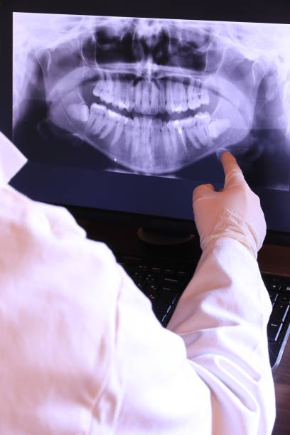 Best Emergency Treatment for Dental Infections or Abscesses in Audubon Park, KY