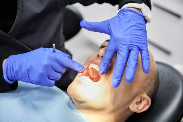 Best Urgent Care for Lost Fillings or Crowns in Audubon Park, KY