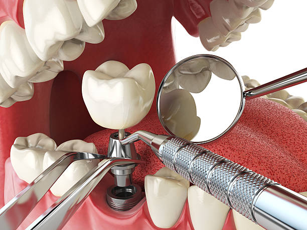 Best Emergency Gum Treatment in Audubon Park, KY